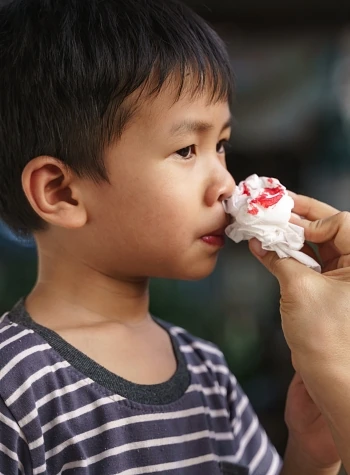 young boy with a nosebleed